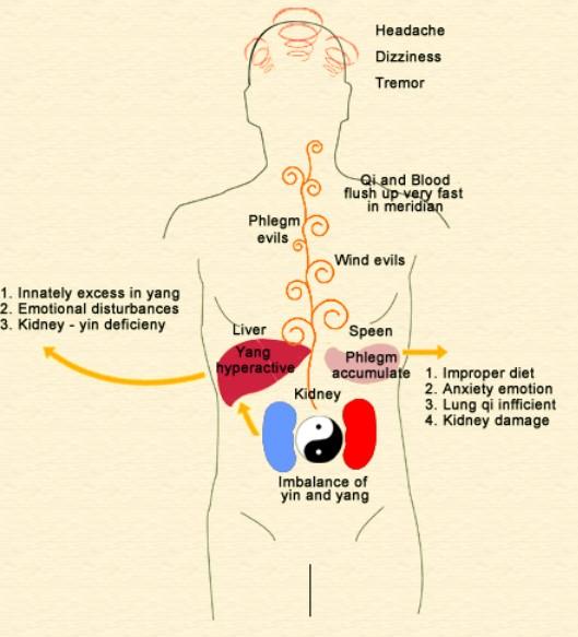 TCM views on the development of hypertension